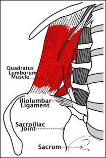 Iliolumbar Ligament Sprain