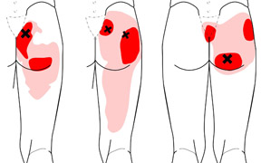 gluteus-maxpiriformis2