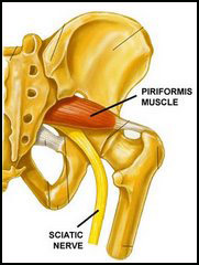 piri-sciatic