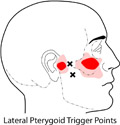 latpterygoid31