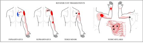 Rotator Cuff Injuries - Intulo Health Remedial and Sport Massage