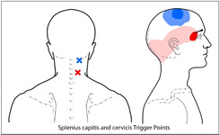 splenius-group