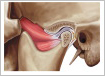 pterygoid-coronoid