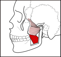 pterygoid-med-lat