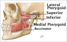 pterygoidsnetter