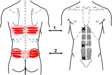 abdominusrectustrpssm-ks