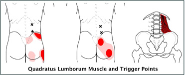 🗣Flank Pain - Quadratus Lumborum👇 . ❓Do you get Pain in this region? What  do you find relieves it? . 🎉Besides sounding like a Harry Potter spell,  the, By The Strength Therapist