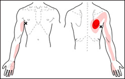 latissimusdorsitrps1