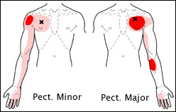 Subclavius  The Trigger Point & Referred Pain Guide