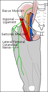 lat-fem-cut-nerve