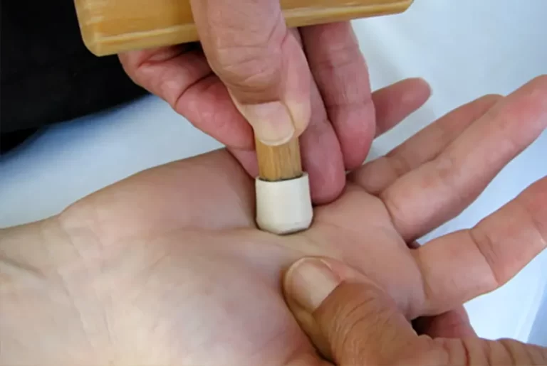 A closeup of hands, with an NMT practitioner using a wooden T-bar tool to press into a trigger point on the inner palm of the patient.